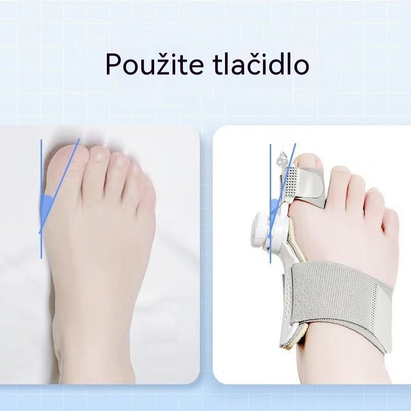 【2 položky】Korektor Hallux valgus prstov s nastaviteľným gombíkom, oddeľovač prstov, unisex korektor vybočeného valgusu.