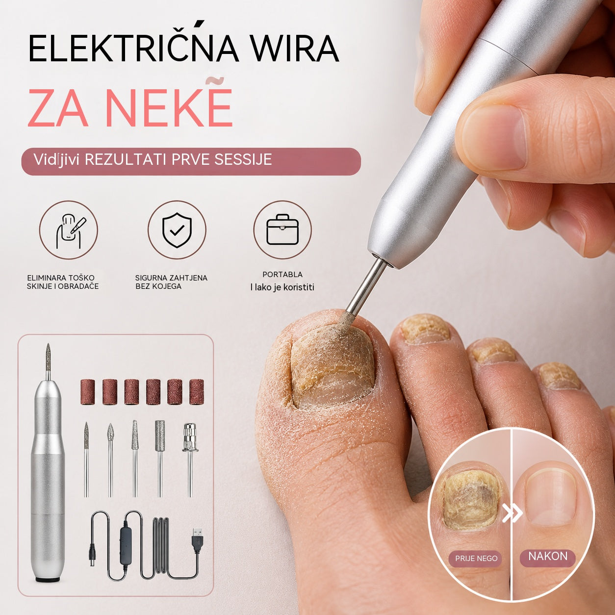 💅👍 Električna turpija za nokte za liječenje onihomikoze