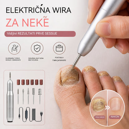💅👍 Električna turpija za nokte za liječenje onihomikoze