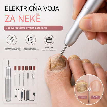 💅👍 Električna pilica za nohte za zdravljenje onihomikoze