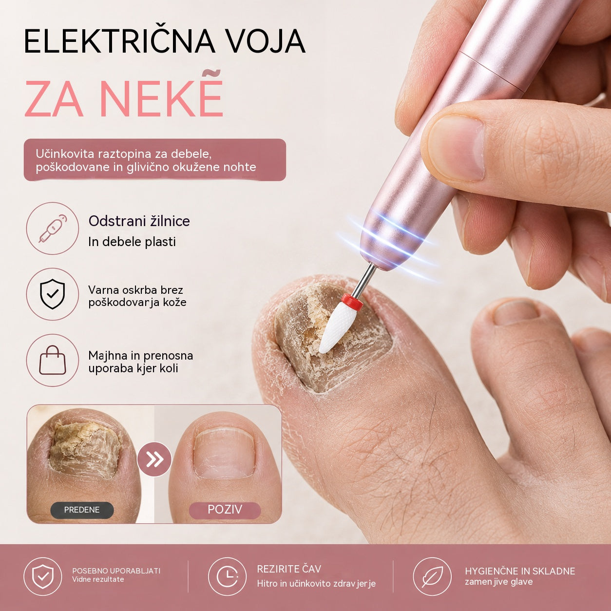 💅👍 Električna pilica za nohte za zdravljenje onihomikoze