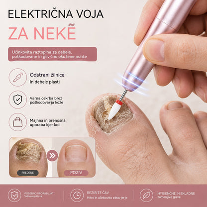 💅👍 Električna pilica za nohte za zdravljenje onihomikoze