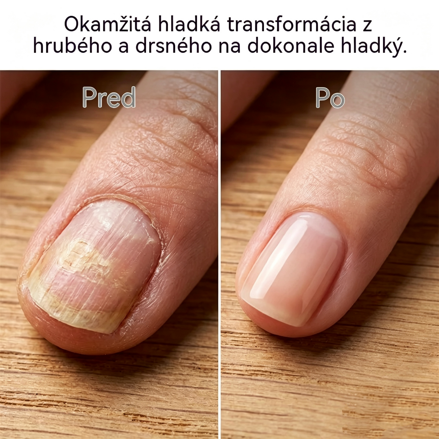 💅✨Profesionálny elektrický leštič na nechty – Ľahko leští hrubé nechty a používa sa na liečbu onychomykózy.
