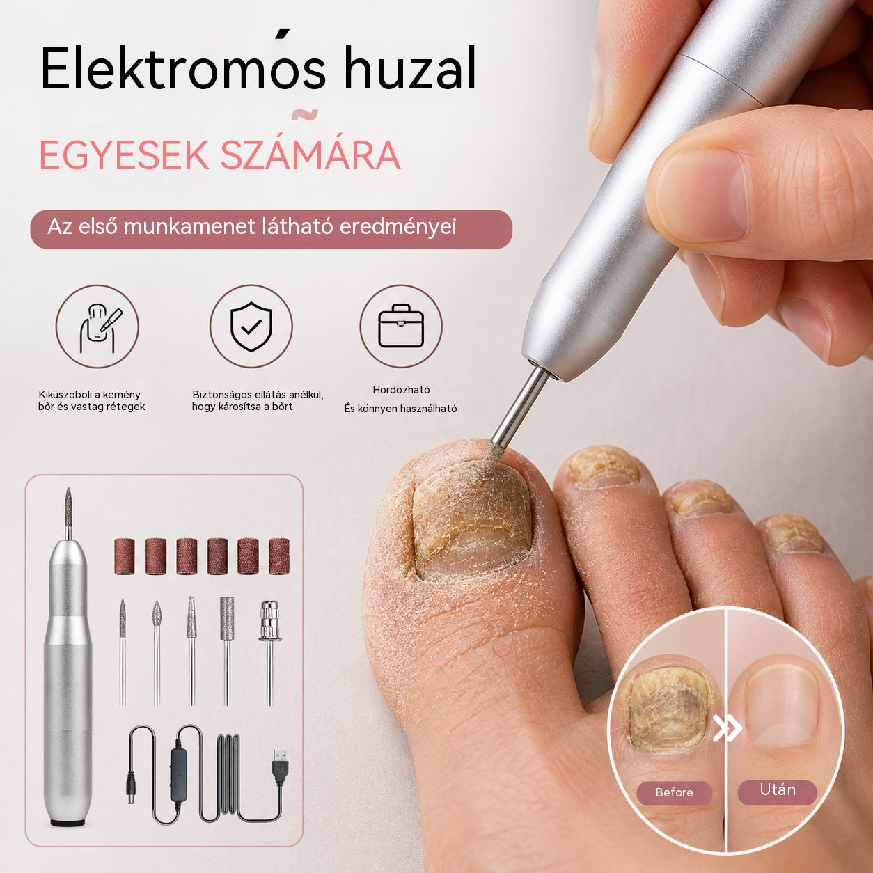 💅👍 Elektromos körömreszelő az onychomycosis kezelésére