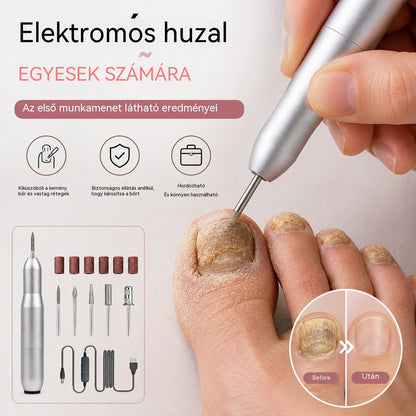 💅👍 Elektromos körömreszelő az onychomycosis kezelésére