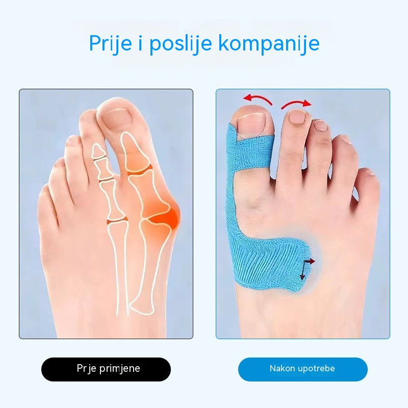 【50 komada】 Elastični zavoji za prste, zavoji za opekline, izdržljivi sportski zavoji