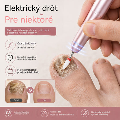 💅👍 Elektrický pilník na nehty používaný k léčbě onychomykózy (plísně nehtů)