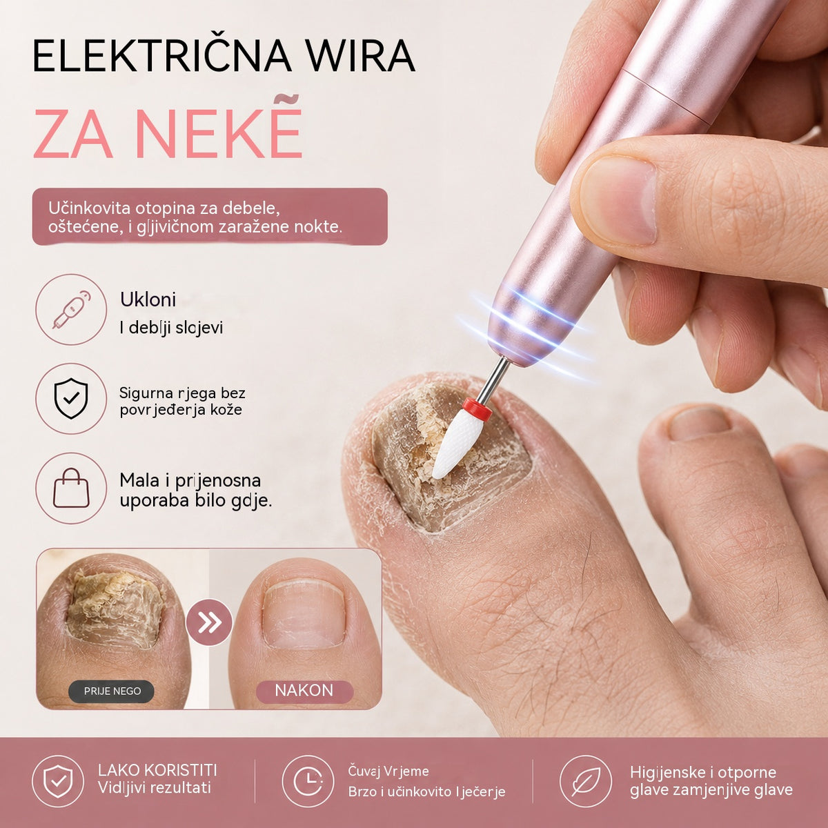 💅👍 Električna turpija za nokte za liječenje onihomikoze