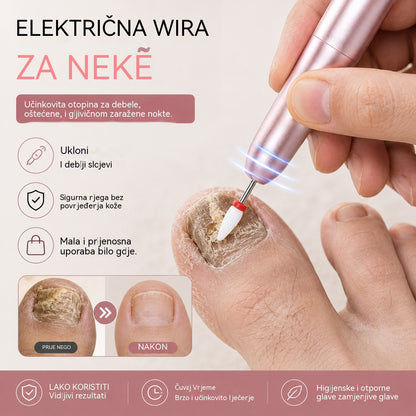 💅👍 Električna turpija za nokte za liječenje onihomikoze