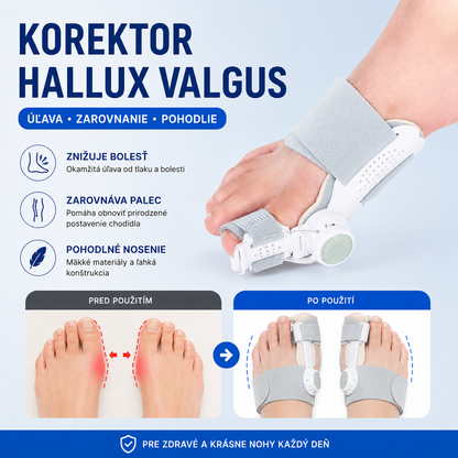 👍Nastaviteľný korektor pre palce na nohách, pre hallux valgus